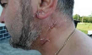 Паламар УПЦ МП з криками «За Русь, за веру!» ледь не зарізав українського священика 