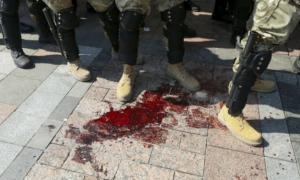 25-річний хлопець порізав собі вени під Радою