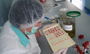 Польські студенти розробили унікальний прилад для визначення групи крові за три хвилини 