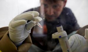 Вчені зі США створили першу універсальну вакцину від Еболи