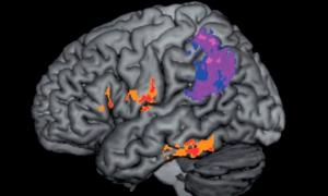 Вчені ідентифікували відповідальні за правопис зони мозку