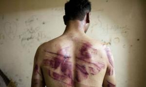 Незалежна комісія ООН оприлюднила доповідь щодо тортур та вбивств затриманих у Сирії
