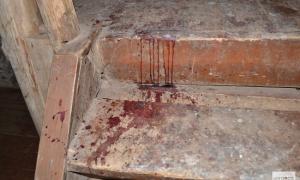 У сімферопольській поліклініці через обвалення сходів отримала переломи 9-річна дівчинка
