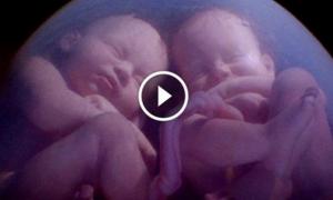 Близнята побилися в утробі матері (відео)