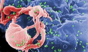Учені відкрили антитіло, яке знищує 96% штамів ВІЛ
