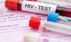 Медики створили препарат, який блокує передачу ВІЛ статевим шляхом

