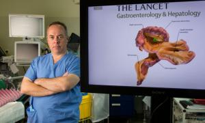 Ірландський професор відкрив новий орган в тілі людини
