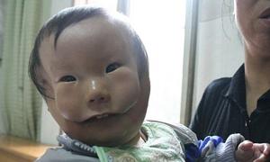 У віддаленому селі Китаю живе хлопчик із двома обличчями