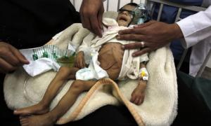 ООН: На Ємен насувається масовий голод