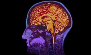 Вчені виростили міні-мозок для вивчення епілепсії і аутизму