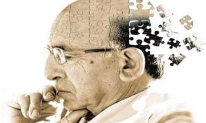 Ризиковані зміни в мозку починаються за десятиліття до появи симптомів хвороби Альцгеймера