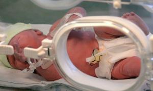 У новонародженого хлопчика виявили два статевих органи