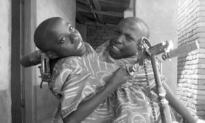 У Танзанії у віці 21 року померли популярні сіамські близнюки