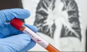 В Україні хворих на коронавірус перевалило за 14 тисяч на добу