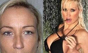 Німецький пластичний хірург перекроїв дружину до невпізнанності