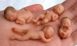 Британка народила дві пари близнюків протягом одного року