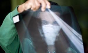 У Британії перші смертельні випадки через ліки від грипу А