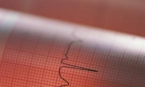 Інфаркт і інсульт можна заморозити