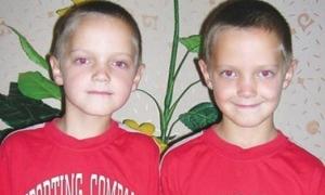 Тривалість життя людини можна визначити за її обличчям