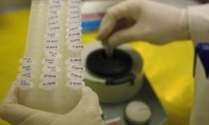 Звукові кулі проти ракових пухлин винайшли у США