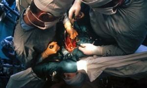 Через борги по кредитах латвійці продають органи