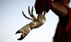 Британець намагався зробити собі обрізання щипцями