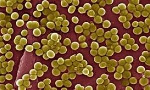 У закарпатському санаторії виявили збудники сальмонели і стафілококу