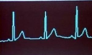 Американські лікарі укомплектували кардіостимулятор модулем Wi-Fi