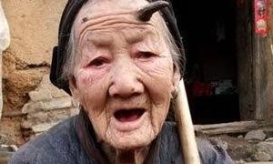 У столітньої жінки на лобі виріс ріг