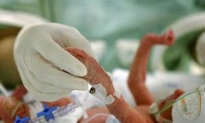 Українські лікарі навчилися рятувати недоношених дітей