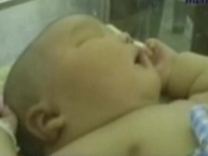 У Індонезії народилось немовля вагою 9 кг